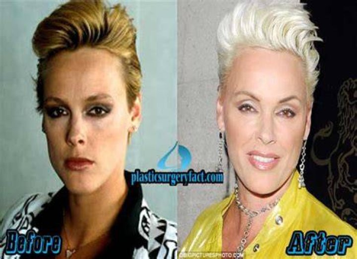 Brigitte Nielsen’s plastic surgery kinda worked