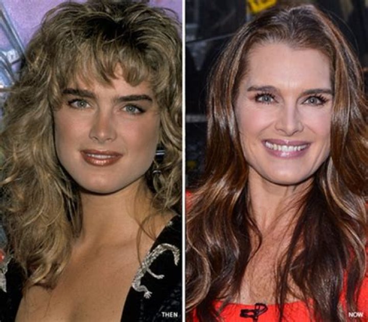 Brooke Shields Nose Job