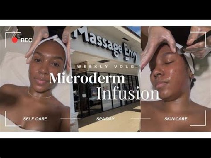 How long does a Microderm infusion last?