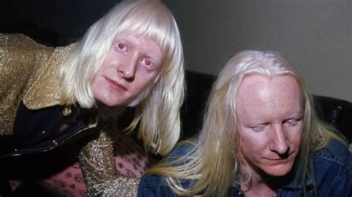 Is Edgar Winter Albino?