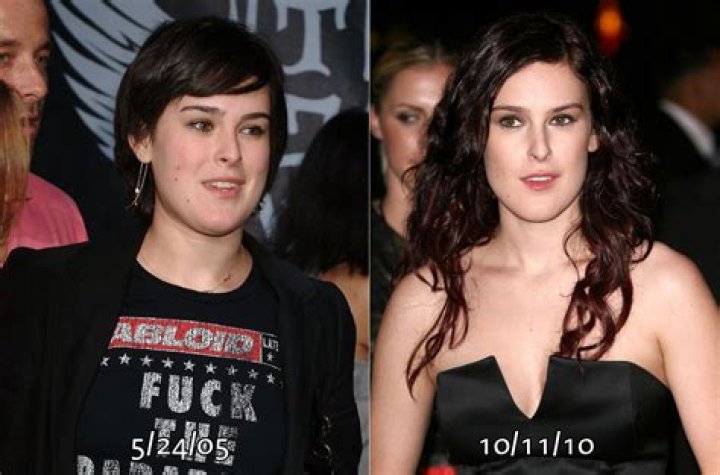 rumerbeforeafter