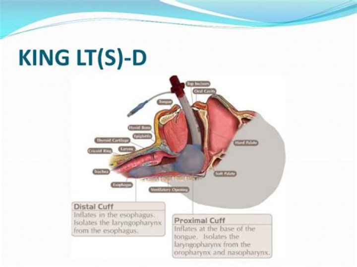 What is a King LT?
