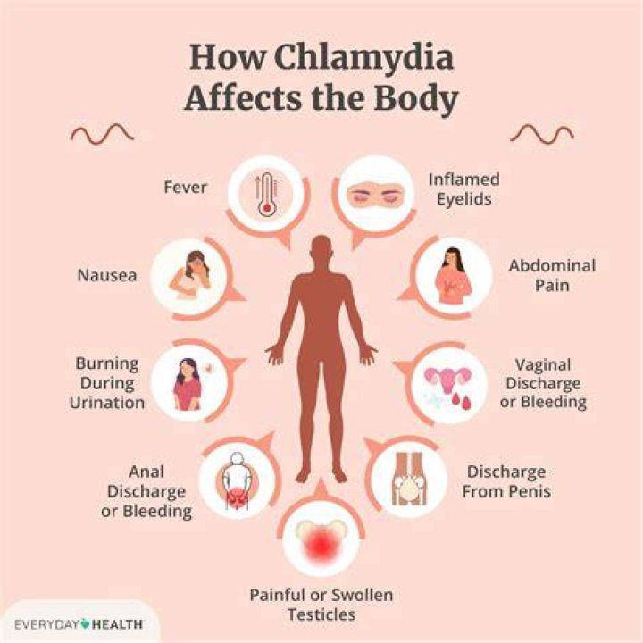 What is the nickname for chlamydia?