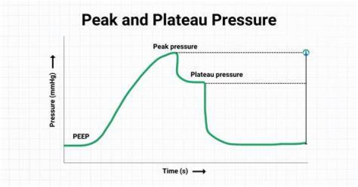 What is the normal range for plateau pressure?