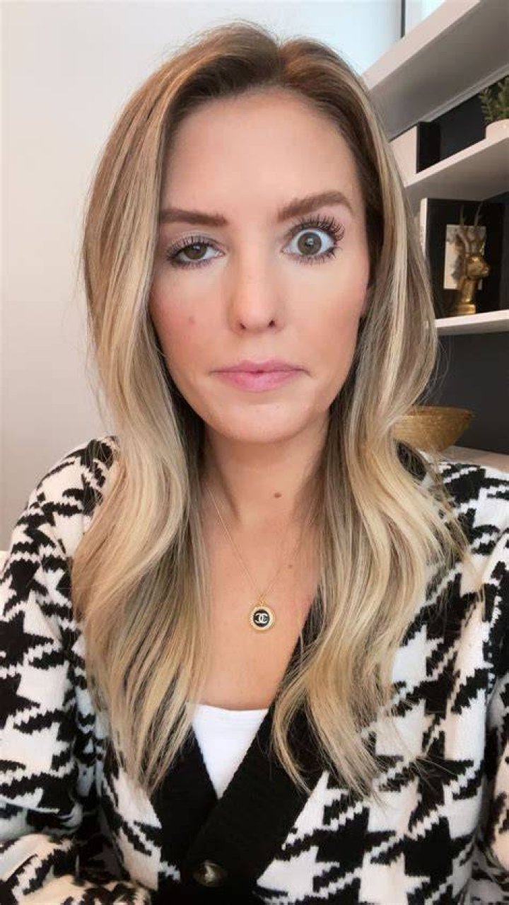 Whitney Buha raised some eyebrows with her Botox gone wrong video! Whitney Buha raised some eyebrows with her Botox gone wrong video!